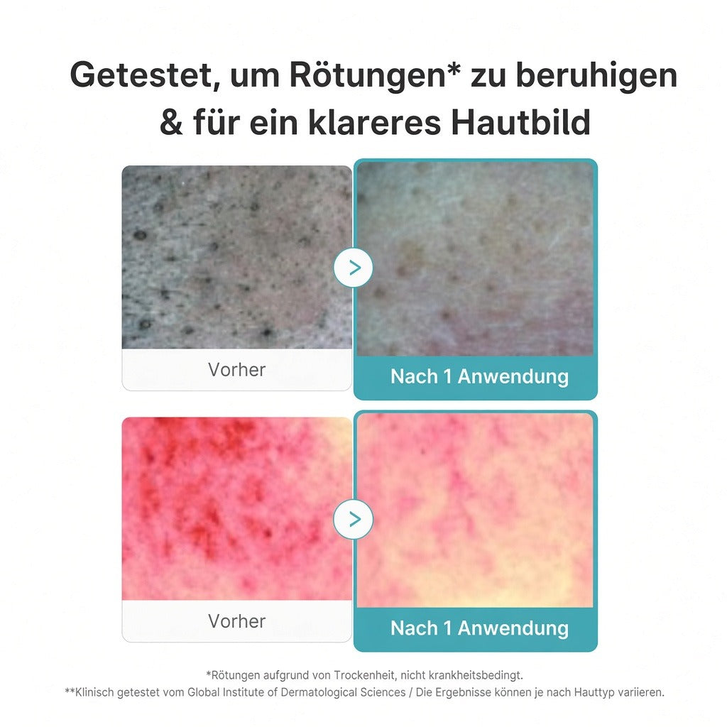 Azelainsäure Kapsel-Reinigungsschaum