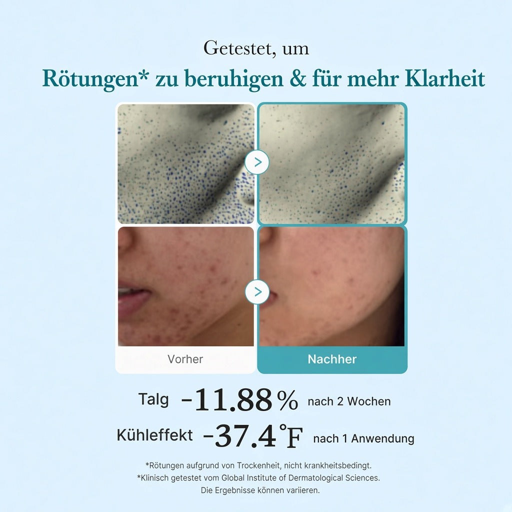 Azelainsäure Niacinamid Klärendes Gesichtswasser