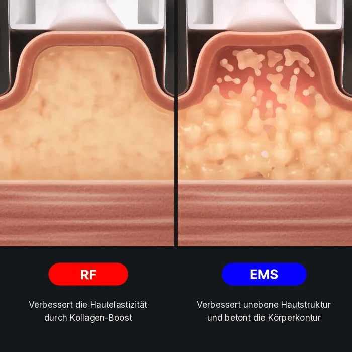 AGE-R Contour Body Shot