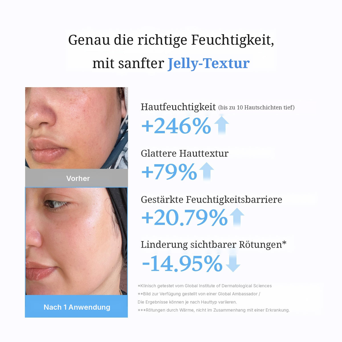 Hyaluron Ceramid Feuchtigkeitsspendende Jelly Creme