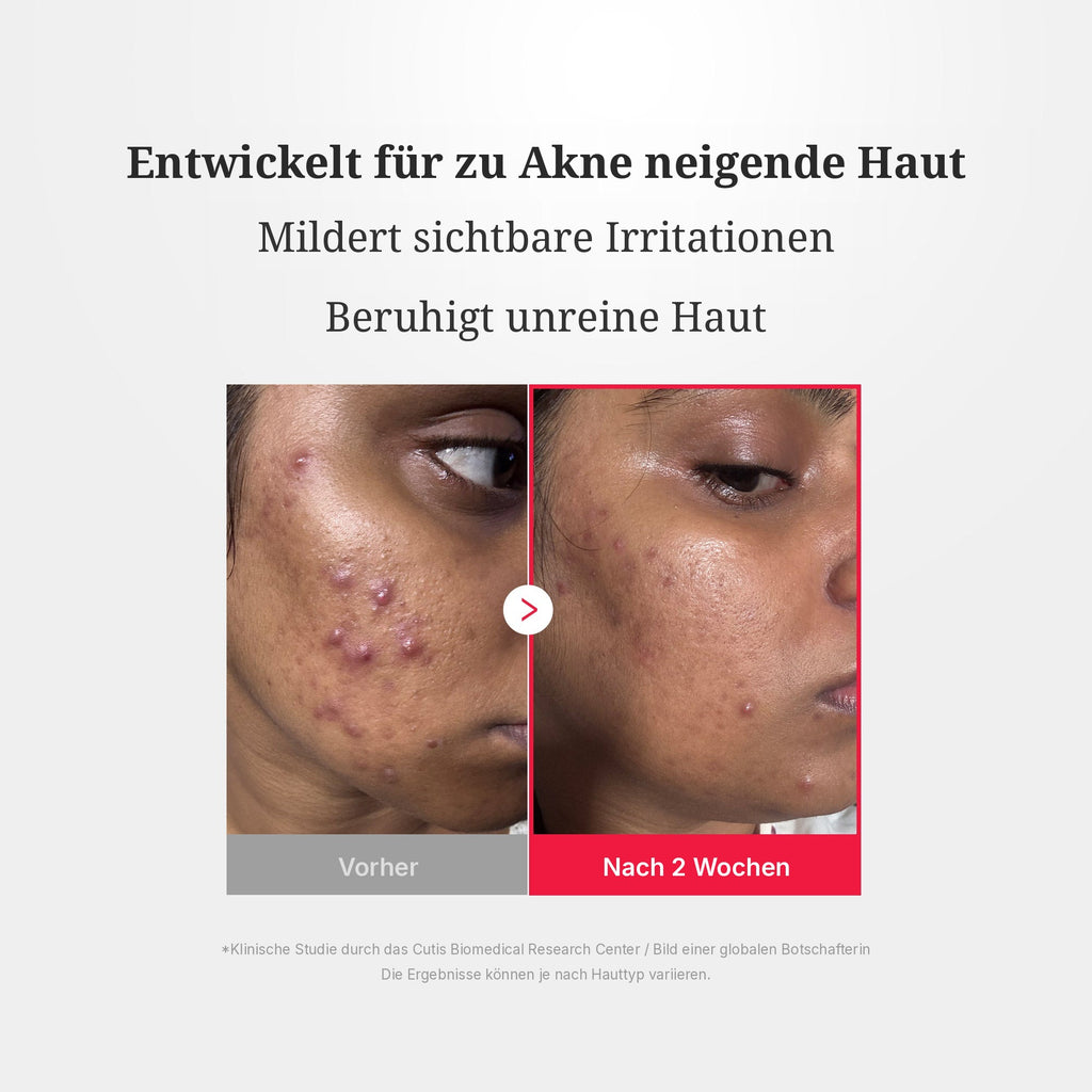 Hypochlorsäure Power Beruhigendes Spray