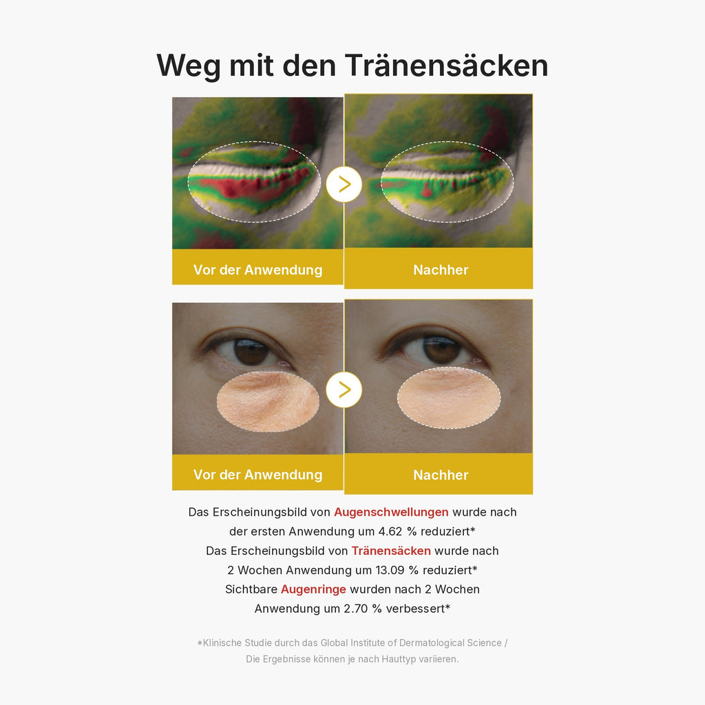 Kojisäure Kurkuma Augen-Gelserum