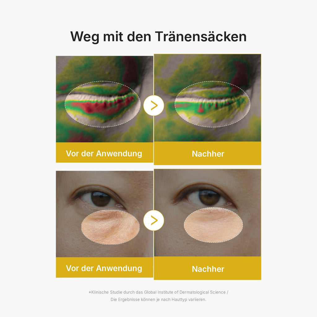Kojisäure Kurkuma Augen-Gelserum