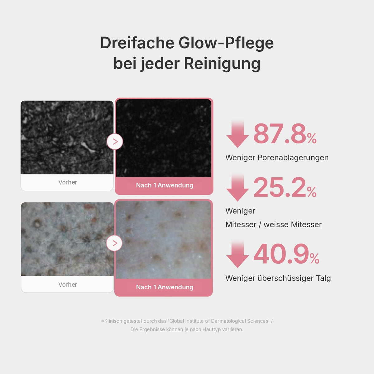 PDRN Pink Glutathion Kapsel-Reinigungsschaum
