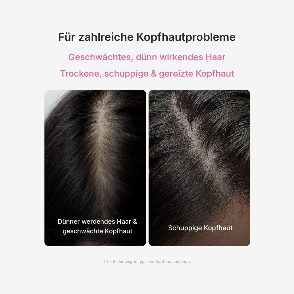Rosmarin PDRN Kopfhaut-Serum