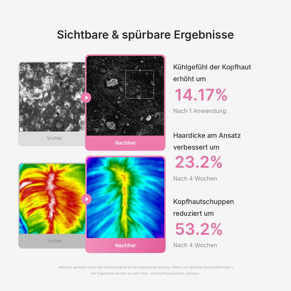 Rosmarin PDRN Kopfhaut-Serum