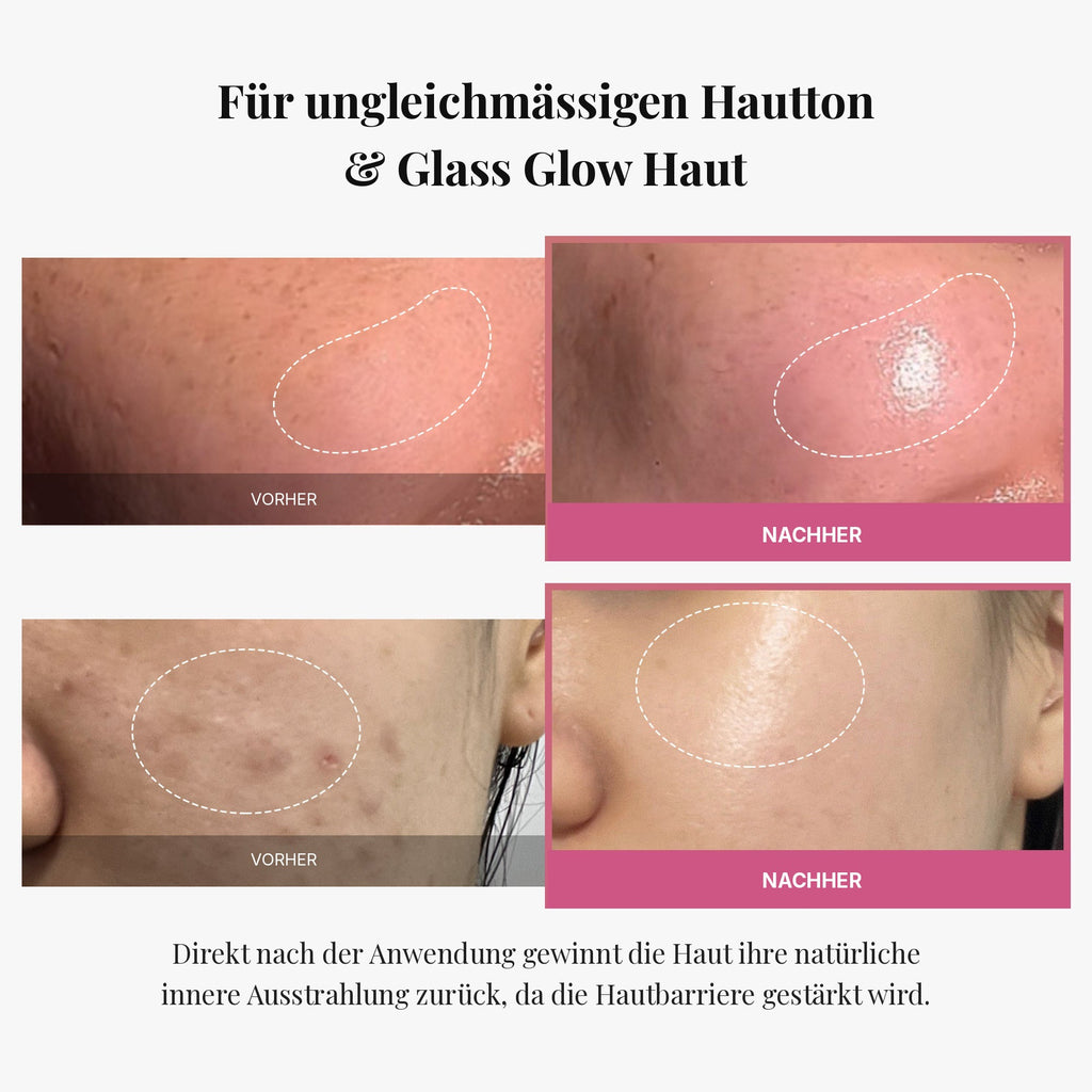 [Tati's Exclusive] All About Glow Set
