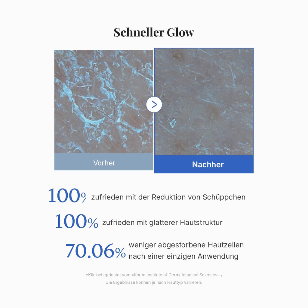 Zero Pore Peeling Pads (8 Stück)