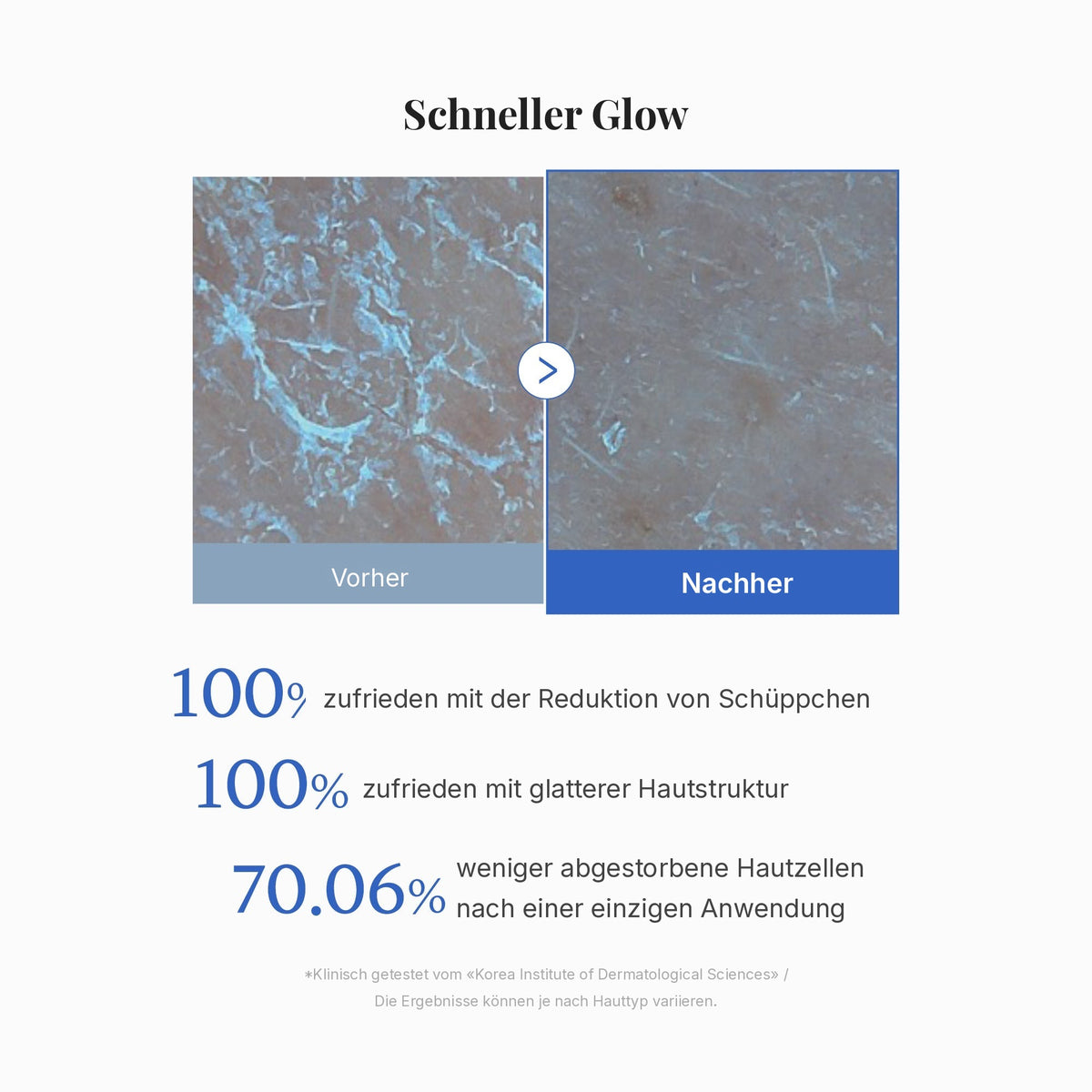 Zero Pore Peeling Pads (8 Stück)